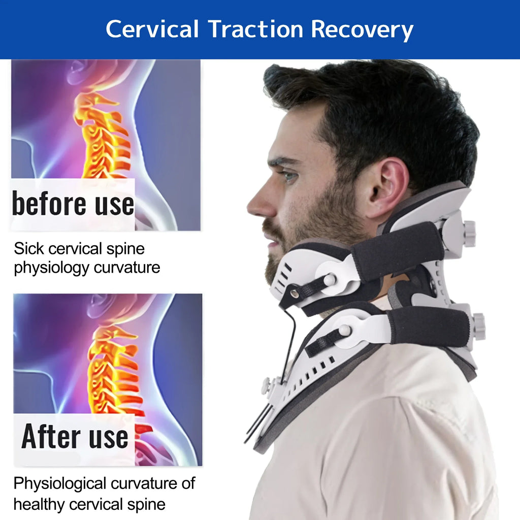 Neck Brace Support Orthosis, Adjustable Cervical Collar, Fixable Neck Posture Corrector, Pain Relief, Traction Spine Alignment TAVEN System LLC