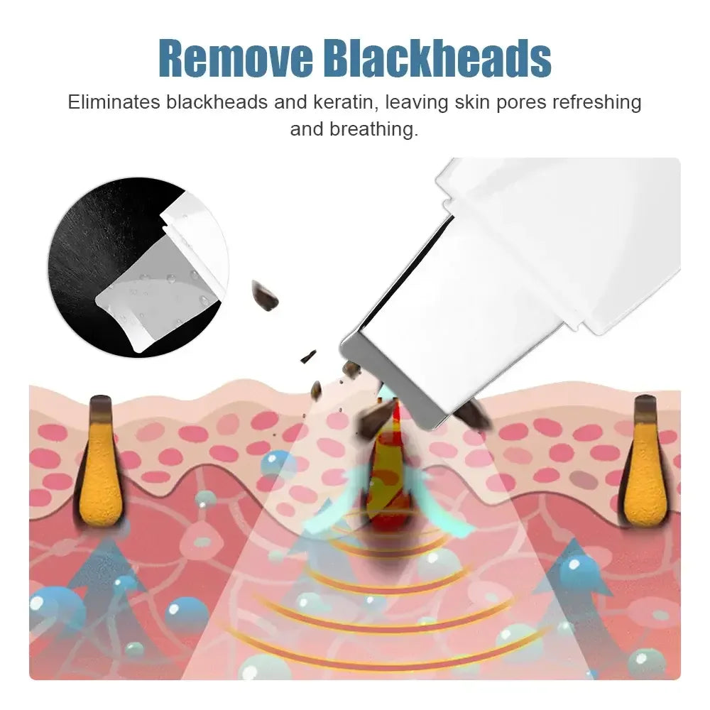 Deep Vibrate Skin Scrubber Facial Cleaner Shovel Spatula Not Ultrasonic Face ScrubberPeeling Blackhead Remover Facial Ma ssager TAVEN System LLC