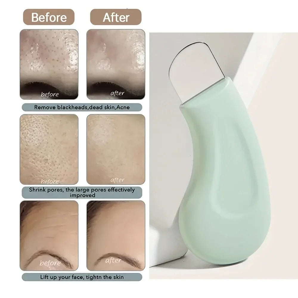 1 Piece Of Manual Blackhead Scraper, Blackhead Remover, Facial Beauty Tool For Removing Acne And Dead Skin TAVEN System LLC