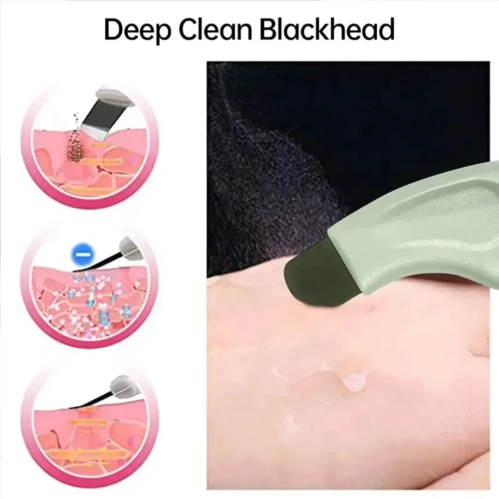 1 Piece Of Manual Blackhead Scraper, Blackhead Remover, Facial Beauty Tool For Removing Acne And Dead Skin TAVEN System LLC